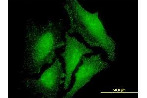 Immunofluorescence of monoclonal antibody to LMO3 on HeLa cell. (LMO3 抗体  (AA 91-146))