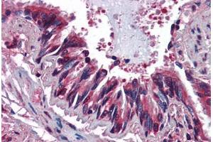 Human Lung, Respiratory Epithelium (formalin-fixed, paraffin-embedded) stained with CCR3 antibody ABIN364440 at 10 ug/ml followed by biotinylated anti-mouse IgG secondary antibody ABIN481714, alkaline phosphatase-streptavidin and chromogen. (CCR3 抗体)