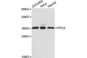 Western blot analysis of extracts of various cell lines, using PPCS antibody (ABIN6293765) at 1:3000 dilution. (PPCS 抗体)