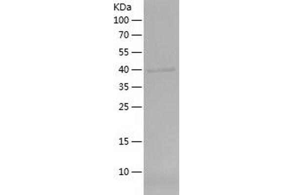 DMC1 Protein (AA 1-176) (His-IF2DI Tag)