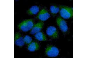 IF analysis of Ch TOG/CKAP5 using anti-Ch TOG/CKAP5 antibody (ABIN7599106).