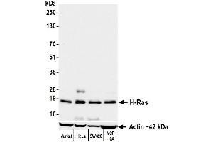 Western Blotting (WB) image for anti-HRas proto-oncogene, GTPase (HRAS) (AA 50-100) antibody (ABIN7795770) (Recombinant HRAS 抗体  (AA 50-100))