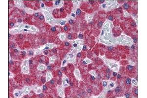 Immunohistochemistry Image: Human Liver: Formalin-Fixed, Paraffin-Embedded (FFPE) (SCD 抗体  (C-Term))