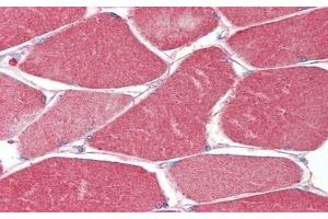 Detection of MUSK in Human Skeletal Muscle Tissue using Polyclonal Antibody to Muscle, Skeletal, Receptor Tyrosine Kinase (MUSK)