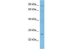 Western Blotting (WB) image for anti-Carnitine Palmitoyltransferase 1A (Liver) (CPT1A) (Middle Region) antibody (ABIN2782010)