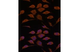 Immunofluorescence analysis of L929 cells using USP19 antibody  at dilution of 1:100. (USP19 抗体  (AA 1-200))