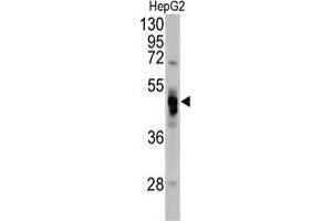 Western blot analysis of GLA antibody (N-term) in Hela cell line lysates (35 µg/lane).