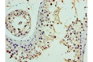 Immunohistochemistry of paraffin-embedded human testis tissue using ABIN7161152 at dilution of 1:100 (NPHP1 抗体  (AA 1-109))
