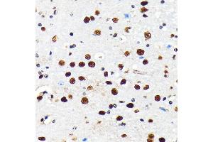 Immunohistochemistry of paraffin-embedded mouse brain using HD antibody (ABIN7267708) at dilution of 1:100 (40x lens). (HDAC2 抗体)