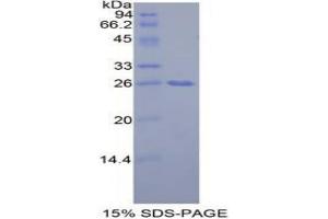SDS-PAGE analysis of Mouse GRB7 Protein. (GRB7 蛋白)