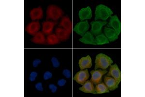 ABIN6260864 and ABIN6266508 staining Hela cells(45 min of heat-shock treatment) by IF/ICC.