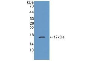 Detection of Recombinant MUC1, Human using Polyclonal Antibody to Mucin 1 (MUC1) (MUC1 抗体  (AA 1034-1151))