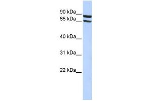 Western Blotting (WB) image for anti-Solute Carrier Family 6 (Neutral Amino Acid Transporter), Member 15 (SLC6A15) antibody (ABIN2458798) (SLC6A15 抗体)