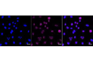 Immunocytochemical staining of C2C12 cells with Phospho-MEK1 (T292) antibody (ABIN7799463), 1:1,000). (Recombinant MEK1 抗体  (pThr292))