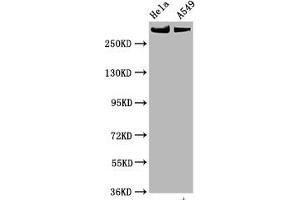 Western Blot Positive WB detected in Hela whole cell lysate,A549 whole cell lysate All lanes Phospho-MTOR antibody at 0. (Recombinant MTOR 抗体  (pSer2448))