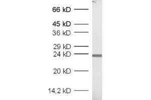 dilution: 1 : 1000, sample: recombinant protein (GFP 抗体  (AA 183-191))