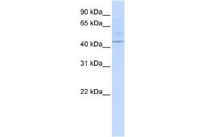 LAX1 antibody used at 1 ug/ml to detect target protein. (LAX1 抗体  (Middle Region))