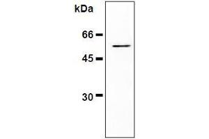 Western Blotting (WB) image for anti-Vimentin (VIM) antibody (ABIN1109487) (Vimentin 抗体)