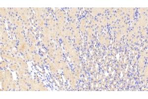 Detection of TMOD3 in Mouse Kidney Tissue using Polyclonal Antibody to Tropomodulin 3 (TMOD3) (TMOD3 抗体  (AA 1-352))