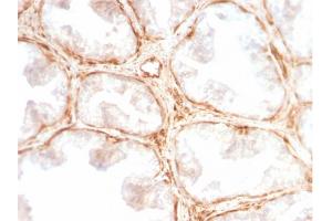 Immunohistochemistry (IHC) image for anti-Lectin, Galactoside-Binding, Soluble, 1 (LGALS1) (AA 12-108) antibody (ABIN6939959)
