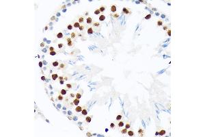 Immunohistochemistry of paraffin-embedded rat testis using PI+PI Rabbit mAb (ABIN7266879) at dilution of 1:100 (40x lens). (E3 SUMO-Protein Ligase PIAS3 (LOC101740849) 抗体)