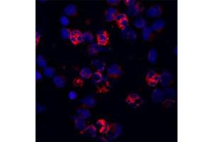 Staining of a cytospin preparation of peripheral blood mononuclear cells (PBMC) isolated from buffycoat. (Cathelicidin 抗体)