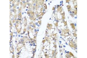 Immunohistochemistry of paraffin-embedded Human stomach using TNFAIP6 Polyclonal Antibody at dilution of 1:100 (40x lens). (TNFAIP6 抗体)