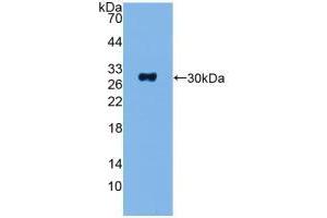 Western blot analysis of recombinant Human ADCY1. (ADCY1 抗体  (AA 835-1061))