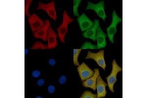 FGFR1/2 Mouse Monoclonal Antibody staining HepG2 cells by IF/ICC. (FGFR1/FGFR2 抗体)