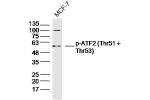 MCF-7 lysates probed with p-ATF2 (Thr51 + Thr53) Polyclonal Antibody, Unconjugated  at 1:300 dilution and 4˚C overnight incubation. (ATF2 抗体  (pThr51, pThr53))