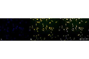 Immunocytochemistry/Immunofluorescence analysis using Rabbit Anti-Rab5 Polyclonal Antibody . (RAB5 抗体  (FITC))