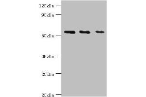 Western blot All lanes: TGF-beta-activated kinase 1 and MAP3K7-binding protein 1 antibody at 7 μg/mL Lane 1: K562 whole cell lysate Lane 2: Hela whole cell lysate Lane 3: Mouse heart tissue Secondary Goat polyclonal to rabbit IgG at 1/10000 dilution Predicted band size: 55, 50 kDa Observed band size: 55 kDa (TAB1 抗体  (AA 205-504))