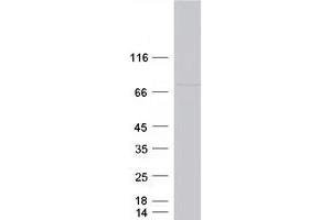 Validation with Western Blot