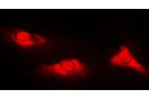 Immunofluorescent analysis of DJ-1 staining in Jurkat cells. (PARK7/DJ1 抗体  (Center))