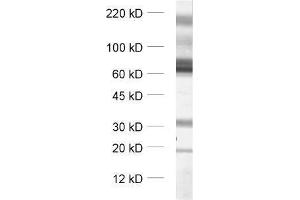 Western Blotting (WB) image for anti-Solute Carrier Family 1 (Glial High Affinity Glutamate Transporter), Member 3 (SLC1A3) (Cytoplasmic Domain) antibody (ABIN2690503)