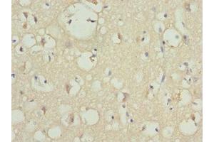 Immunohistochemistry of paraffin-embedded human brain tissue using ABIN7163186 at dilution of 1:100 (PIP5K1B 抗体  (AA 190-470))