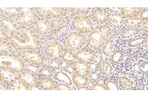 Detection of ALT in Human Kidney Tissue using Monoclonal Antibody to Alanine Aminotransferase (ALT) (ALT 抗体  (AA 255-492))