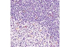 BTK antibody immunohistochemistry analysis in formalin fixed and paraffin embedded human tonsil tissue. (BTK 抗体  (AA 27-55))