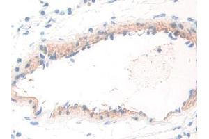 DAB staining on IHC-P; Samples: Rat Lung Tissue (WARS 抗体  (AA 140-347))
