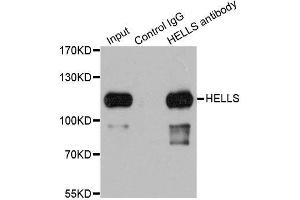 Immunoprecipitation analysis of 200ug extracts of 293T cells using 1ug HELLS antibody. (HELLS 抗体  (AA 719-838))