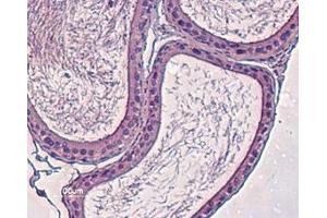 Immunohistochemistry (IHC) image for anti-Potassium Voltage-Gated Channel, Subfamily H (Eag-Related), Member 4 (KCNH4) (AA 881-895), (Intracellular) antibody (ABIN7043547)