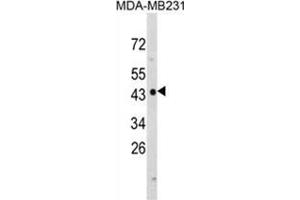 Western blot analysis of NDRG1 Antibody (N-term) in MDA-MB231 cell line lysates (35ug/lane). (NDRG1 抗体  (N-Term))