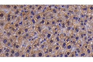 Immunohistochemistry (IHC) image for anti-Sirtuin 5 (SIRT5) (AA 37-310) antibody (ABIN7437188)