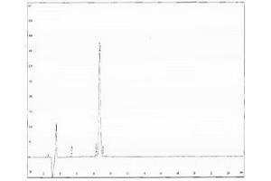 Image no. 2 for Cross Linked C-Telopeptide of Type II Collagen (CTX-II) protein (ABIN1880160) (CTXII 蛋白)