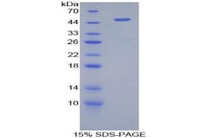 SDS-PAGE analysis of Human Furin Protein. (FURIN 蛋白)