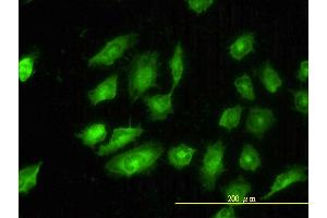 Immunofluorescence of monoclonal antibody to TPM4 on HeLa cell. (Tropomyosin 4 抗体  (AA 1-248))