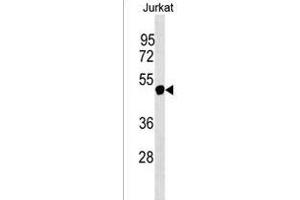 Western Blotting (WB) image for anti-Nuclear RNA Export Factor 5 (NXF5) (AA 53-80), (N-Term) antibody (ABIN1539447)