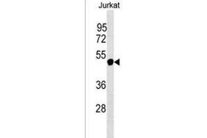 NXF5 Antibody (N-term) (ABIN1539447 and ABIN2849866) western blot analysis in Jurkat cell line lysates (35 μg/lane). (NXF5 抗体  (N-Term))