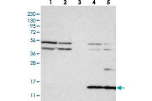 Western blot analysis of Lane 1: RT-4, Lane 2: U-251 MG, Lane 3: Human Plasma, Lane 4: Liver, Lane 5: Tonsil with CYB561D1 polyclonal antibody . (CYB561D1 抗体)
