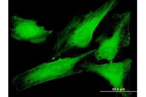 Immunofluorescence of purified MaxPab antibody to PTTG1IP on HeLa cell. (PTTG1IP 抗体  (AA 1-180))